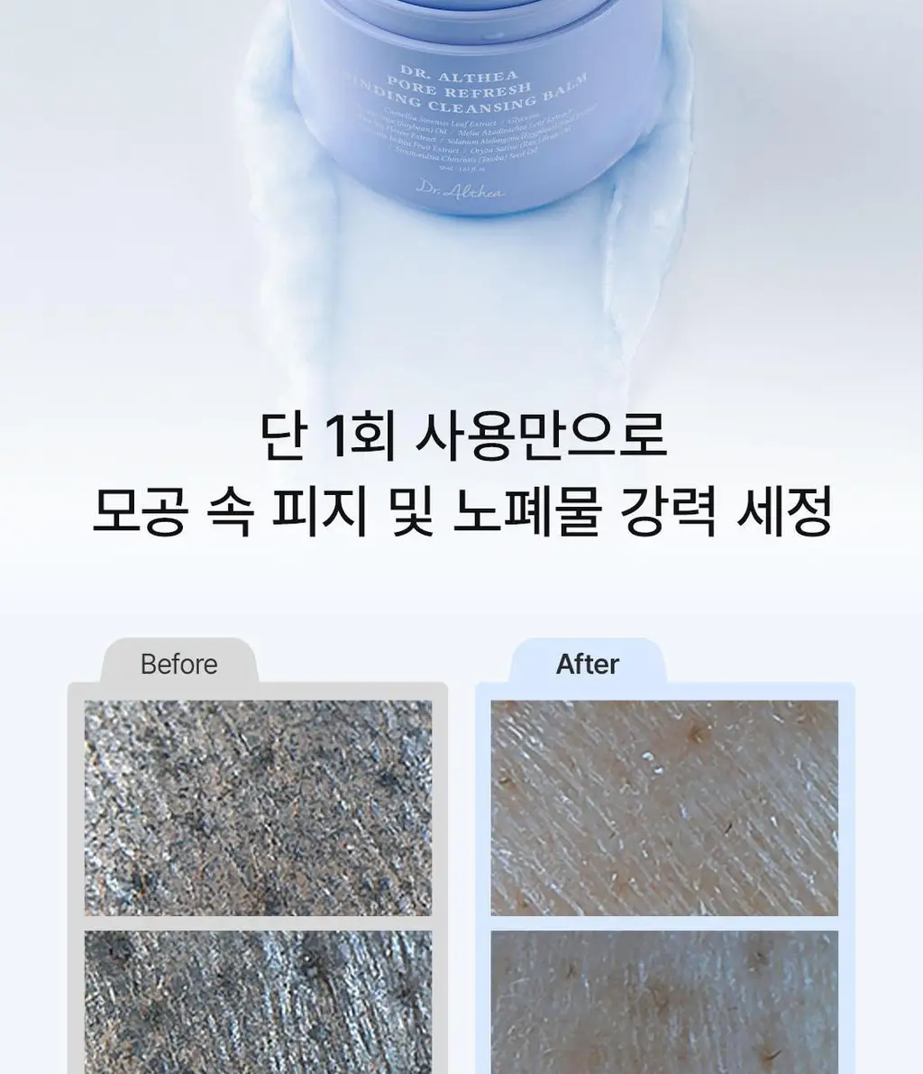 [포어깎아밤] 닥터엘시아 포어 리프레쉬 그라인딩 클렌징밤 50ml 상세페이지 7
